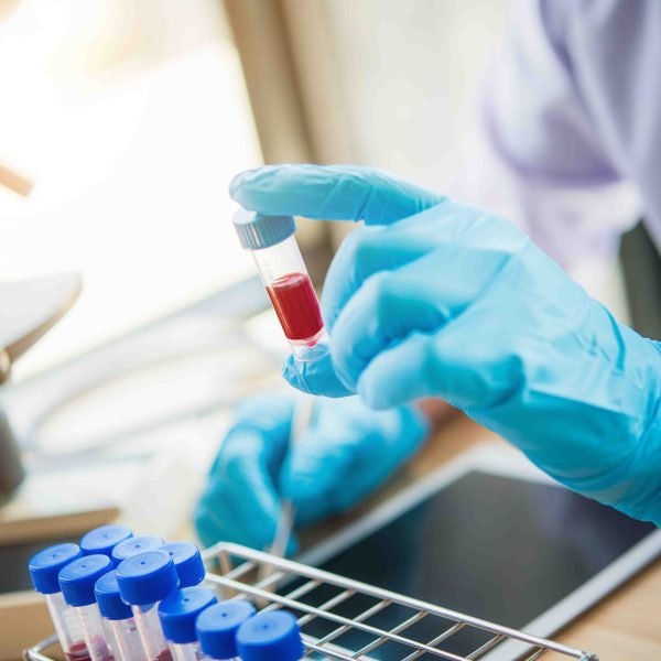 lab technician assistant analyzing a blood sample in test tube a